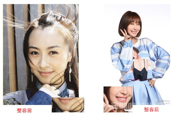 李菲儿整容前后对比照曝光 遭baby抢走黄晓明