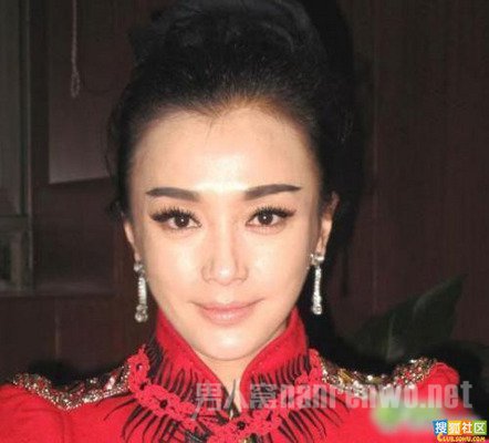 秦岚整容削脸下颌骨变形 秦岚整容前后照片连